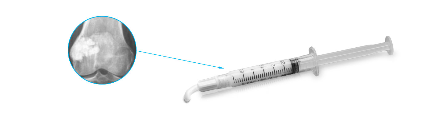 surginibs bone substitute radiography