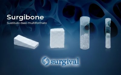 Surgibone: Ventajas diferenciales en el tratamiento de fracturas y osteotomías