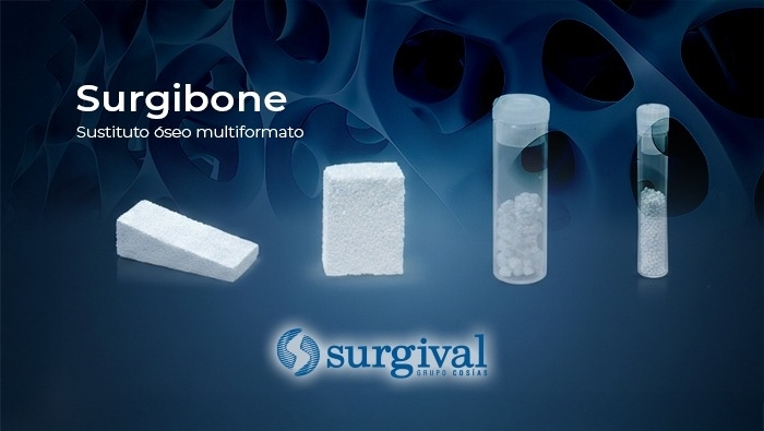 Surgibone: Ventajas diferenciales en el tratamiento de fracturas y osteotomías